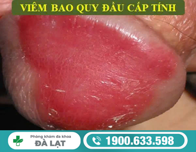 Hình ảnh minh họa